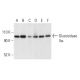 Glucosidase IIα Antibody (D-1) - Western Blotting - Image 403801