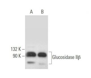 Glucosidase II&beta; Antibody (D-1) - Western Blotting - Image 373169 