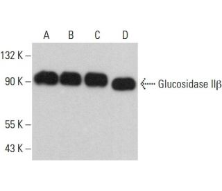Glucosidase II&beta; Antibody (H-4) - Western Blotting - Image 360217 