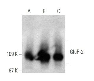 western blotting image from recommended GluR-2 (7G6) monoclonal antibody replacement. Image 370478
