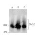 western blotting image from recommended GluR-2 (7G6) monoclonal antibody replacement. Image 370478