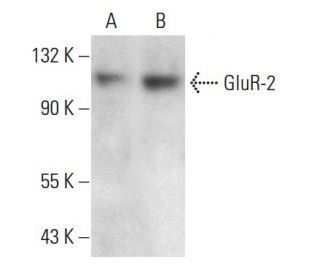 GluR-2 Antibody (7G6) - Western Blotting - Image 376411The Double Nickase Plasmid features a U6 promoter for sgRNA expression, a 20 nt targeting sequence, and a gRNA scaffold to guide Cas9n. It includes a CBh promoter for Cas9n (D10A) and puromycin resistance, GFP for transfection verification, and nuclear localization signals (NLS). The 2A peptide allows co-expression of Cas9n and Puro from a single promoter, enabling precise genome editing with reduced off-target effects.