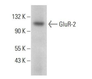 GluR-2 Antibody (7G6) - Western Blotting - Image 380707The Double Nickase Plasmid features a U6 promoter for sgRNA expression, a 20 nt targeting sequence, and a gRNA scaffold to guide Cas9n. It includes a CBh promoter for Cas9n (D10A) and puromycin resistance, GFP for transfection verification, and nuclear localization signals (NLS). The 2A peptide allows co-expression of Cas9n and Puro from a single promoter, enabling precise genome editing with reduced off-target effects.