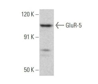 western blotting image from recommended GluR-5 (E-12) monoclonal antibody replacement. Image 358661