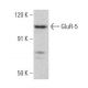 western blotting image from recommended GluR-5 (E-12) monoclonal antibody replacement. Image 358661