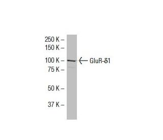 GluR-δ1 Antibody (2B7) - Western Blotting - Image 33528Each CRISPR/Cas9 Knockout (KO) Plasmid product consists of a pool of 3 plasmids designed to ensure identification and cleavage of a specific gene for maximum knockout efficiency. Each plasmid encodes a unique 20 nt sequence derived from the GeCKO (v2) library.