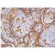 immunohistochemistry image from recommended Glucose Transporter Glut1 (A-4) monoclonal antibody replacement. Image 359497