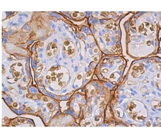 immunohistochemistry image from recommended Glucose Transporter Glut1 (A-4) monoclonal antibody replacement. Image 359497