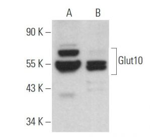 Glucose Transporter Glut10 Antibody (H-10) - Western Blotting - Image 368945 