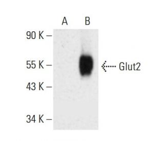 western blotting image from recommended Glucose Transporter Glut2 (C-10) monoclonal antibody replacement. Image 386258