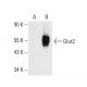western blotting image from recommended Glucose Transporter Glut2 (C-10) monoclonal antibody replacement. Image 386258