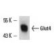 This polyclonal antibody has been discontinued. See our recommended <a href="glut4-antibody-if8">Glucose Transporter Glut4 (IF8)</a> monoclonal antibody (sample data shown). image from recommended Glucose Transporter Glut4 (IF8) monoclonal antibody replacement. Image 13605
