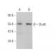 Glucose Transporter Glut6 Antibody (B-3) - Western Blotting - Image 373542