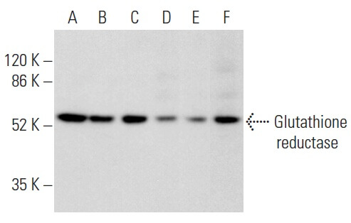 Glutathione reductase Antibody (A-5) | SCBT - Santa Cruz Biotechnology