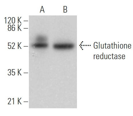 Glutathione reductase Antibody (A-5) | SCBT