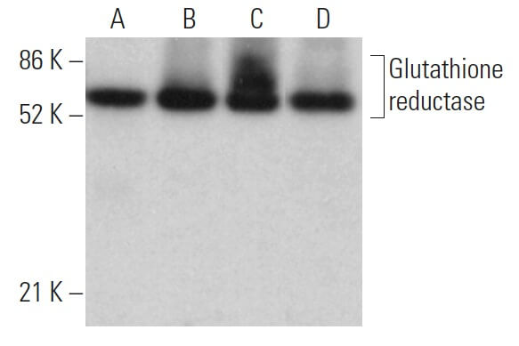 glutathione nem antibody reductase (A-5) | SCBT concern_energy