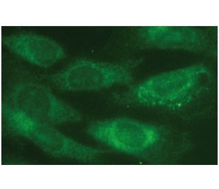 glutathione fluorescent antibody Peroxidase 2/GPX2 Quantitative real-time imaging of glutathione