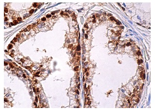 glutathione antibody santa cruz reductase (B-12) Glutathione reductase Antibody (B-12) |