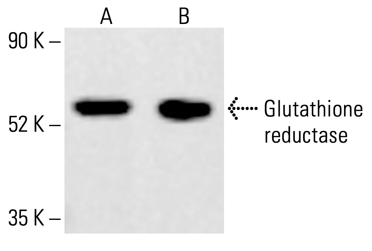 glutathione reducatse reductase Antibody (B-12) | SCBT Comparative Efficacy and Safety FAIRE USA Size:4OZ
