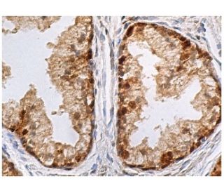 Glutathione reductase Antibody (C-10) | SCBT - Santa Cruz Biotechnology