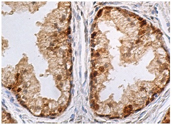 glutathione-reductase-antibody