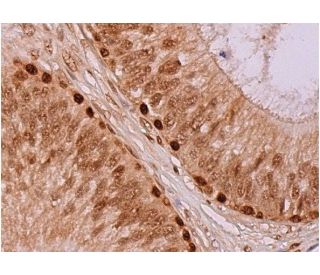 perricone md essential fx acyl glutathione intensive overnight Glutathione reductase Antibody (C-10) | SCBT