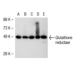 anti glutathione antibody Anti-Glutathione Synthetase Rabbit Monoclonal Antibody - Specific Detection main image 1