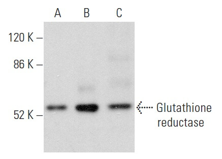 glutathione synthetase antibody Anti-Glutathione Synthetase Rabbit Monoclonal Antibody