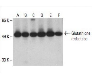 l glutathione vs glutathione which is better L-Glutathione Complex Capsules » Vegan liposomal capsules