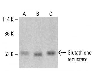 glutathione reductase antibody Glutathione Reductase (GSR) Antibody