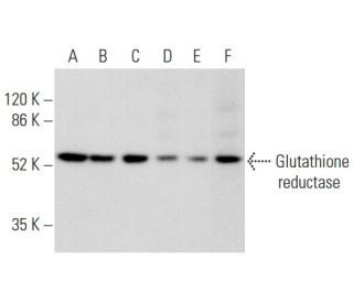 Glutathione reductase Antibody (A-5) - Western Blotting - Image 354874