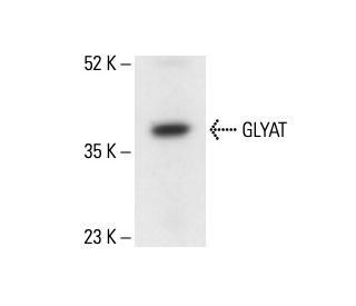 GLYAT Antibody (D-12) - Western Blotting - Image 411259