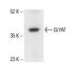 GLYAT Antibody (D-12) - Western Blotting - Image 411259