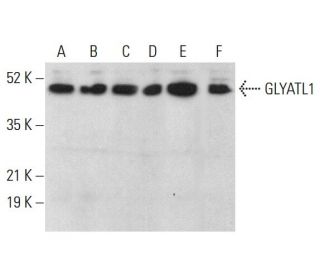 GLYATL1 Antibody (B-12) - Western Blotting - Image 376458 