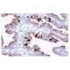 immunohistochemistry image from recommended Glycodelin (001-16-1) monoclonal antibody replacement. Image 17285