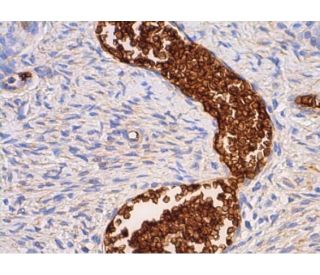 Glycophorin A Antibody (JC159) - Immunohistochemistry - Image 384101 