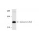 Glycophorin A/B (5F60): sc-71158. Western blot analysis of Glycophorin A/B expression in K-562 whole cell lysate.