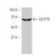 GLYCTK Antibody (N6) - Western Blotting - Image 53983