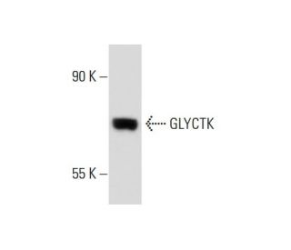 GLYCTK Antibody (N6) - Western Blotting - Image 144735 