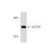 GLYCTK Antibody (N6) - Western Blotting - Image 144735 
