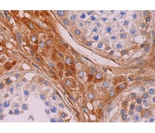 glypican-1 Antibody (A-10) - Immunohistochemistry - Image 372139 