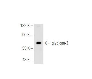 Glypican-3 Antibody (1G12) | SCBT - Santa Cruz Biotechnology