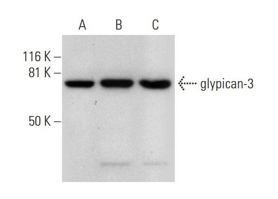 glypican-3 Antibody (F-3) | SCBT - Santa Cruz Biotechnology