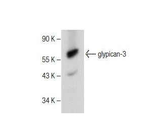 Anti-glypican-3 Antibody (H-10) | SCBT - Santa Cruz Biotechnology