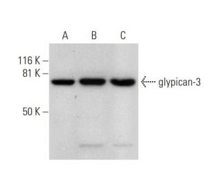western blotting image from recommended glypican-3 (F-3) monoclonal antibody replacement. Image 289590