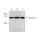 western blotting image from recommended glypican-3 (F-3) monoclonal antibody replacement. Image 289590