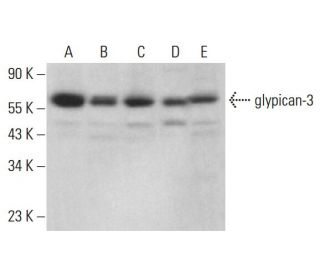 glypican-3 Antibody (H-10) - Western Blotting - Image 379711