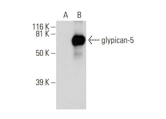 Anti-glypican-5 Antibody (F-3) | SCBT - Santa Cruz Biotechnology