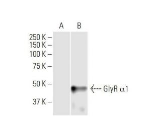 GlyR &alpha;1 Antibody (2E7) - Western Blotting - Image 352113 