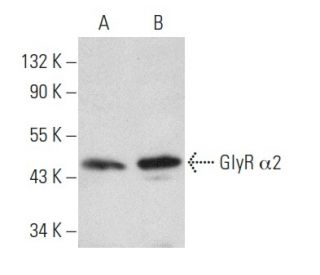 western blotting image from recommended GlyR &alpha;2 (C-11) monoclonal antibody replacement. Image 354415